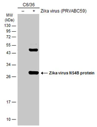 Anti-Zika virus NS4B protein antibody used in Western Blot (WB). GTX133311