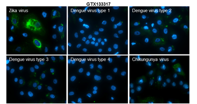 Anti-Zika virus Capsid protein antibody used in Immunocytochemistry/ Immunofluorescence (ICC/IF). GTX133317