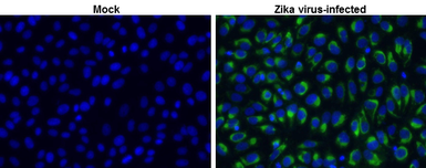 Anti-Zika virus NS2B protein antibody used in Immunocytochemistry/ Immunofluorescence (ICC/IF). GTX133318