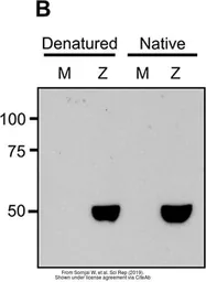Anti-Zika virus Envelope protein antibody used in Western Blot (WB). GTX133326