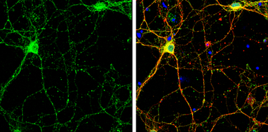 Anti-SHANK2 antibody used in Immunocytochemistry/ Immunofluorescence (ICC/IF). GTX133352