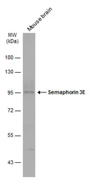 Anti-Semaphorin 3E antibody used in Western Blot (WB). GTX133361