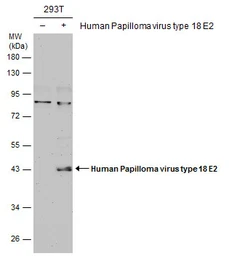 Anti-Human Papillomavirus type 18 E2 antibody used in Western Blot (WB). GTX133373