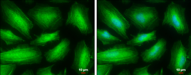 Anti-MYH10 antibody used in Immunocytochemistry/ Immunofluorescence (ICC/IF). GTX133378