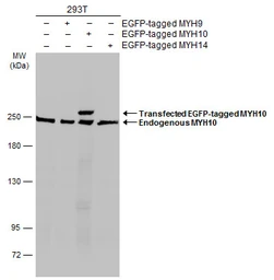 Anti-MYH10 antibody used in Western Blot (WB). GTX133378