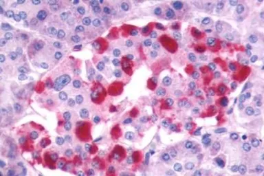 Anti-GRPR antibody used in IHC (Paraffin sections) (IHC-P). GTX13339