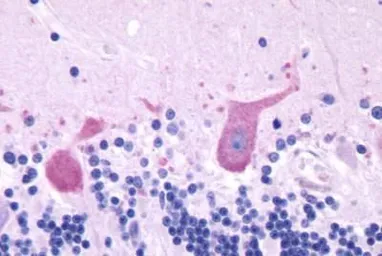 Anti-GRPR antibody used in IHC (Paraffin sections) (IHC-P). GTX13339