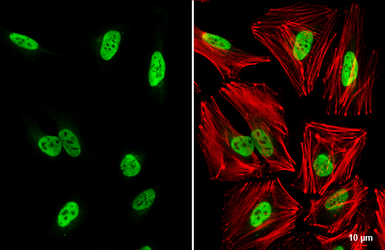 Anti-hnRNP A0 antibody used in Immunocytochemistry/ Immunofluorescence (ICC/IF). GTX133398