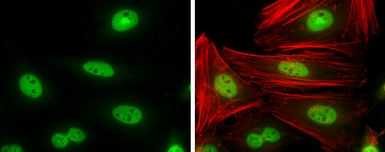 Anti-Cyclin T1 antibody used in Immunocytochemistry/ Immunofluorescence (ICC/IF). GTX133413