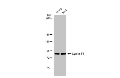 Anti-Cyclin T1 antibody used in Western Blot (WB). GTX133413
