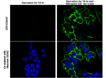 Anti-EGFR (phospho Tyr1173) antibody used in Immunocytochemistry/ Immunofluorescence (ICC/IF). GTX133437