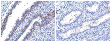 Anti-Her2 / ErbB2 (phospho Tyr1221/Tyr1222) antibody used in IHC (Paraffin sections) (IHC-P). GTX133445