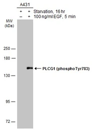 Anti-PLCG1 (phospho Tyr783) antibody used in Western Blot (WB). GTX133465