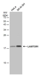 Anti-LAMTOR1 antibody used in Western Blot (WB). GTX133563