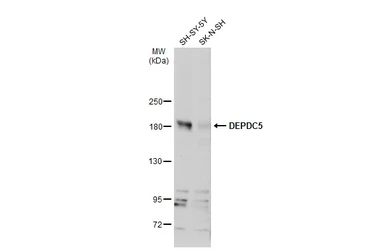 Anti-DEPDC5 antibody used in Western Blot (WB). GTX133570