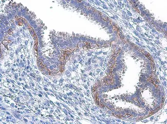 Anti-EGFR (phospho Tyr1086) antibody used in IHC (Paraffin sections) (IHC-P). GTX133599