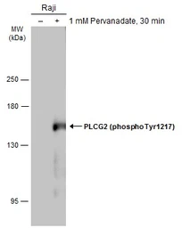 Anti-PLCG2 (phospho Tyr1217) antibody used in Western Blot (WB). GTX133610