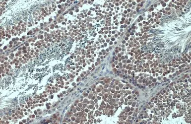 Anti-Importin beta 1 antibody used in IHC (Paraffin sections) (IHC-P). GTX133733