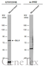 Anti-DLL1 antibody used in Western Blot (WB). GTX133745