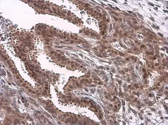 Anti-JNK1 + JNK2 antibody used in IHC (Paraffin sections) (IHC-P). GTX133806