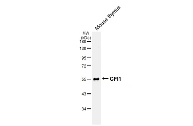 Anti-GFI1 antibody used in Western Blot (WB). GTX133807