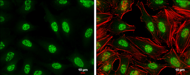 Anti-c-Jun (phospho Ser73) antibody used in Immunocytochemistry/ Immunofluorescence (ICC/IF). GTX133873