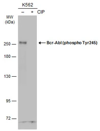 Anti-c-Abl (phospho Tyr245) antibody used in Western Blot (WB). GTX133980