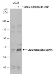 Anti-Chk2 (phospho Ser19) antibody used in Western Blot (WB). GTX133989