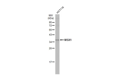 Anti-MSX1 antibody used in Western Blot (WB). GTX134078