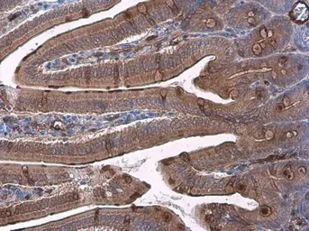 Anti-Trefoil Factor 3 antibody used in IHC (Paraffin sections) (IHC-P). GTX134098