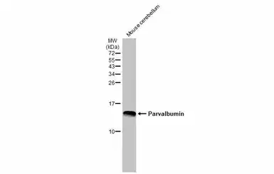 Anti-Parvalbumin antibody used in Western Blot (WB). GTX134110