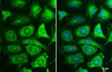 Anti-MEK1 antibody used in Immunocytochemistry/ Immunofluorescence (ICC/IF). GTX134234