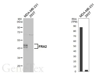 Anti-FRA2 antibody used in Western Blot (WB). GTX134241