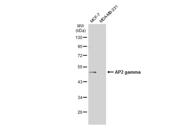 Anti-AP2 gamma antibody used in Western Blot (WB). GTX134259