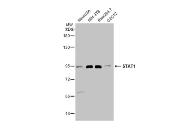 Anti-STAT1 antibody used in Western Blot (WB). GTX134371