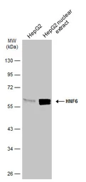 Anti-HNF6 antibody used in Western Blot (WB). GTX134403