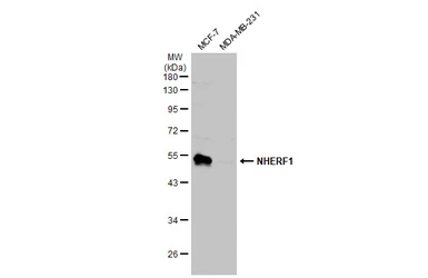 Anti-NHERF1 antibody used in Western Blot (WB). GTX134431