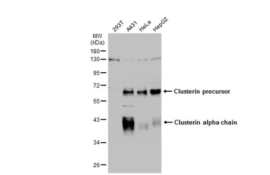 Anti-Clusterin alpha antibody used in Western Blot (WB). GTX134435