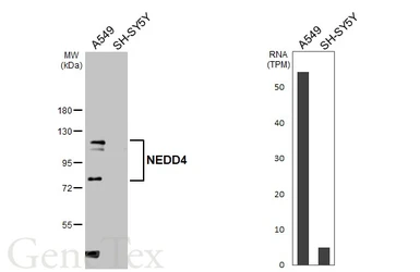 Anti-NEDD4 antibody used in Western Blot (WB). GTX134444