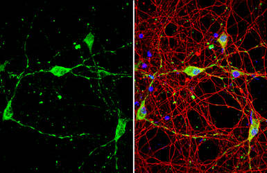 Anti-BACE1 antibody used in Immunocytochemistry/ Immunofluorescence (ICC/IF). GTX134480