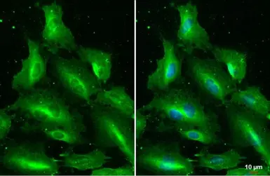Anti-IL33 antibody used in Immunocytochemistry/ Immunofluorescence (ICC/IF). GTX134566