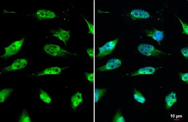 Anti-SIRT1 antibody used in Immunocytochemistry/ Immunofluorescence (ICC/IF). GTX134606