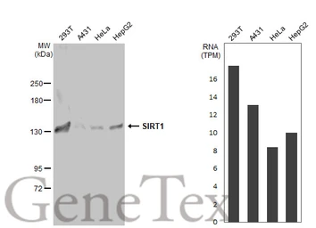 Anti-SIRT1 antibody used in Western Blot (WB). GTX134606