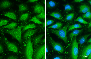 Anti-Talin-1 antibody used in Immunocytochemistry/ Immunofluorescence (ICC/IF). GTX134635