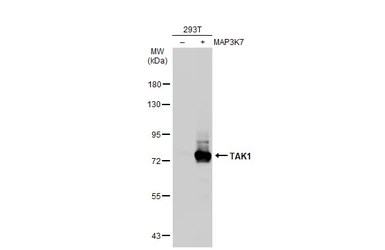 Anti-TAK1 antibody used in Western Blot (WB). GTX134664