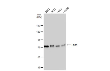 Anti-TAK1 antibody used in Western Blot (WB). GTX134664