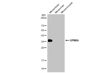 Anti-GPM6A antibody used in Western Blot (WB). GTX134741