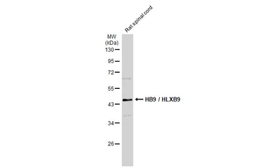 Anti-HB9 / HLXB9 antibody used in Western Blot (WB). GTX134781
