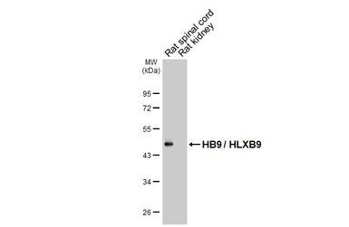 Anti-HB9 / HLXB9 antibody used in Western Blot (WB). GTX134781