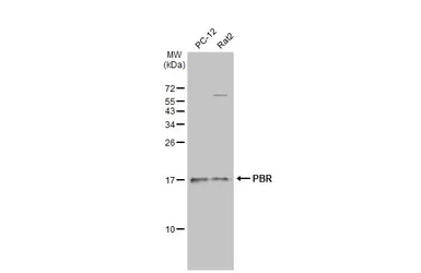 Anti-PBR antibody used in Western Blot (WB). GTX134851